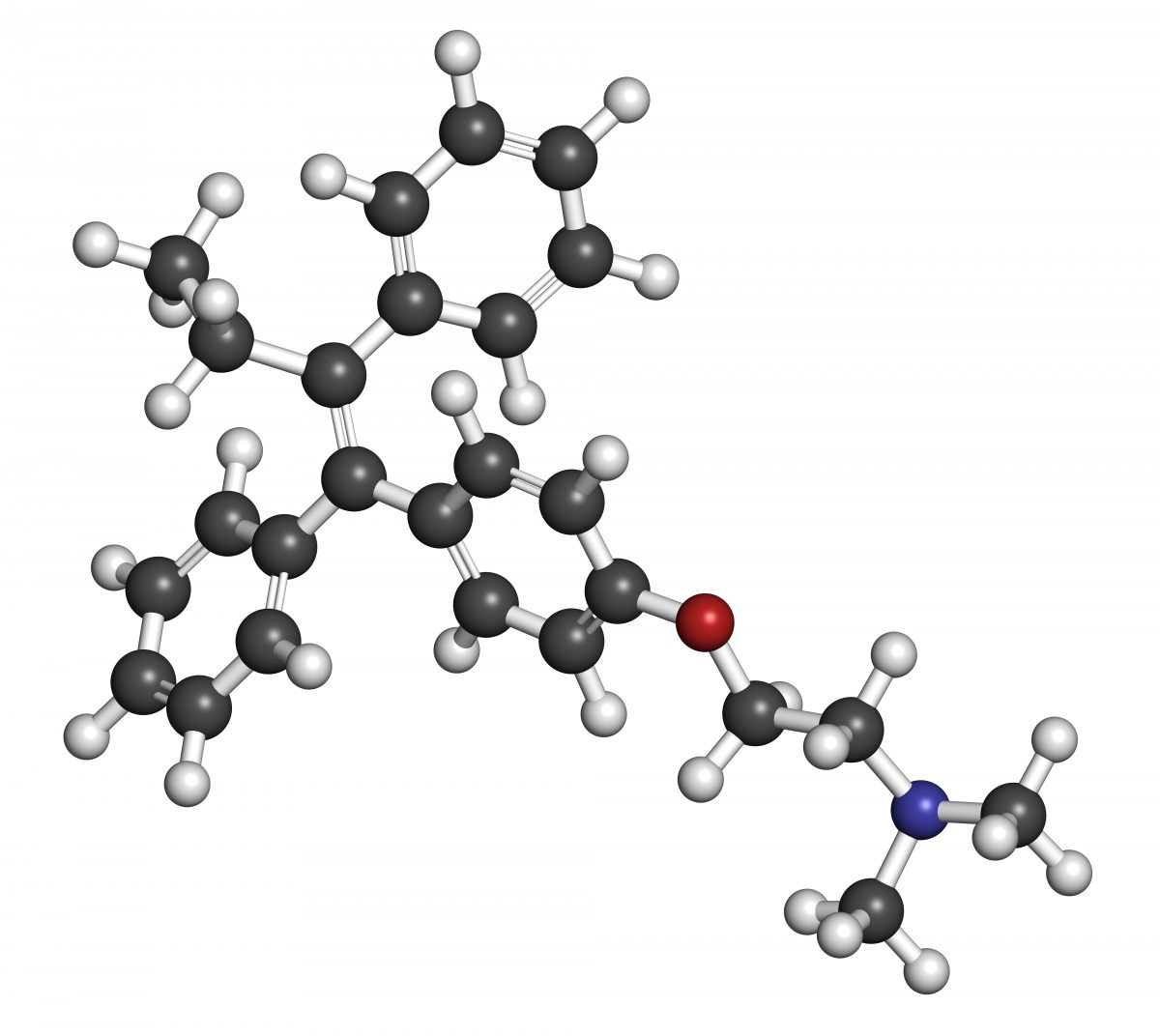 polypoid-endometriosis-rare-complication-of-tamoxifen-treatment