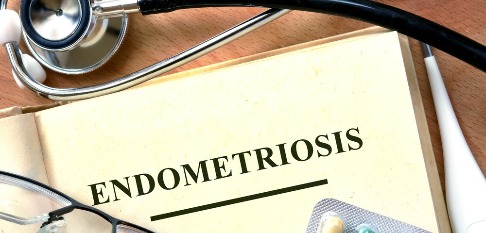 What Causes Endometriosis? 7 Theories