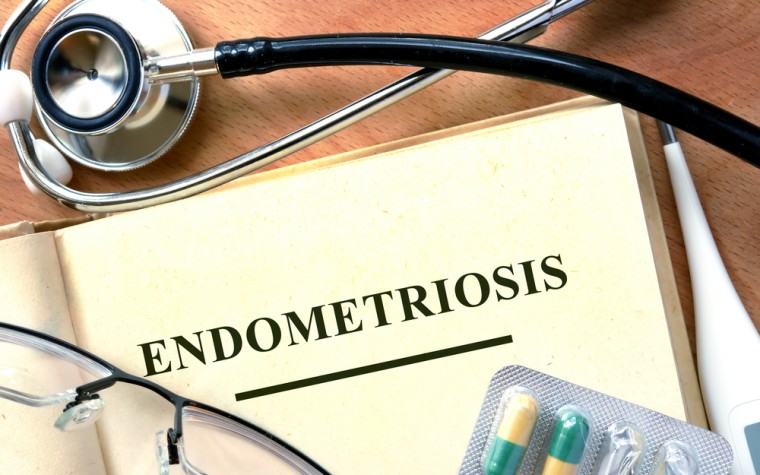 endometriosis theories, advice