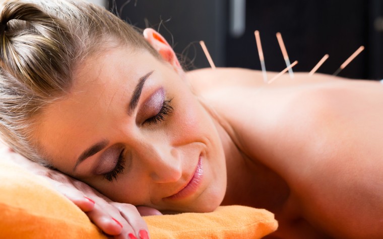 Acupuncture for endometriosis