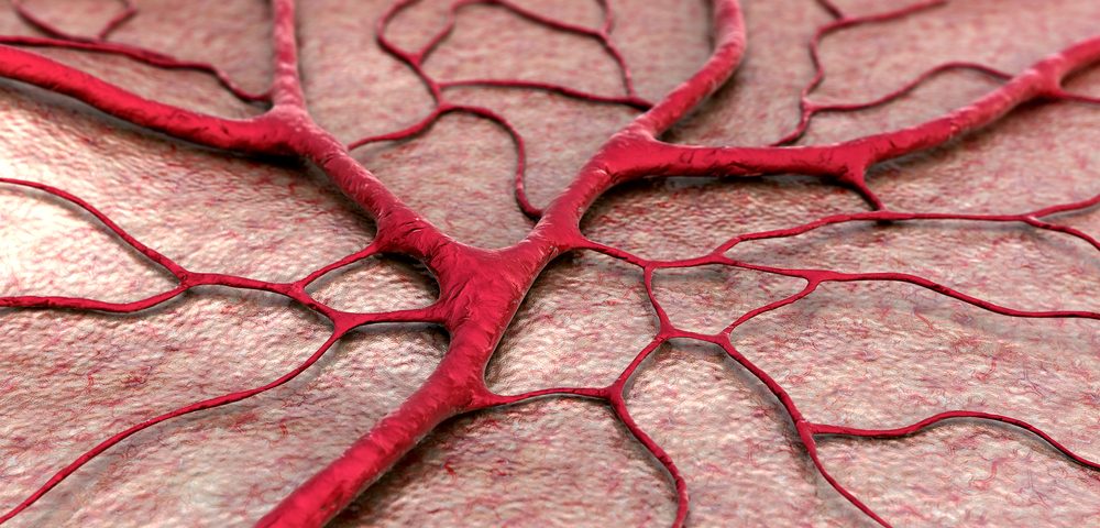 Reducing Blood Vessel Density May Help Treat Endometriosis Patients, Mouse Model Shows
