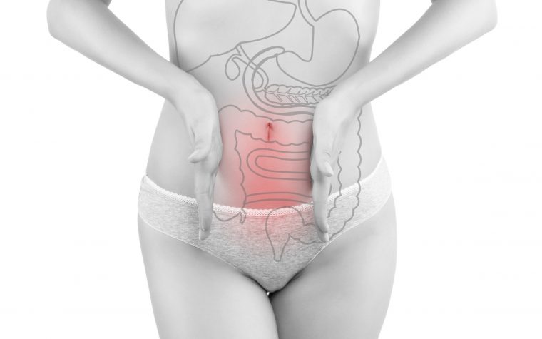 Intestinal endometriosis