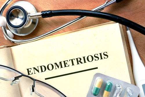 endometriosis presentation