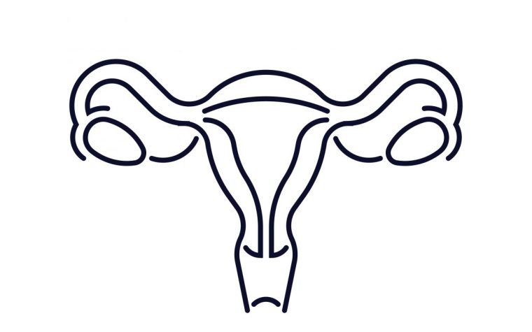 Endometriosis and potential treatment