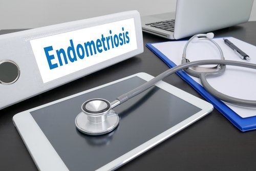 Hysterectomy Is Much Better Than Laparoscopy in Preventing Endometriosis’ Return
