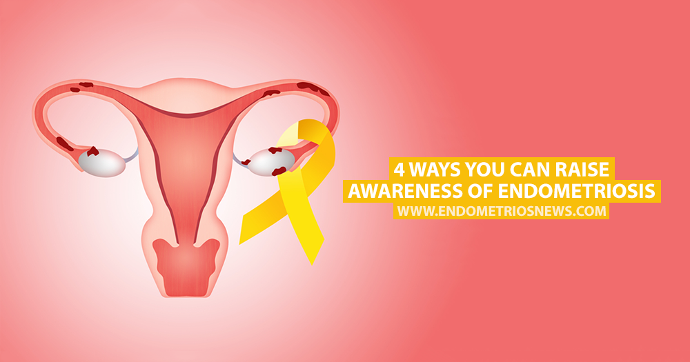 Could You Have Endometriosis? - University Health News
