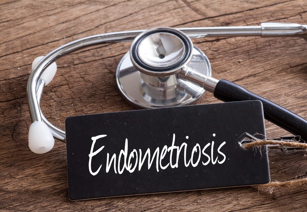 6 Things to Know About Endometriosis