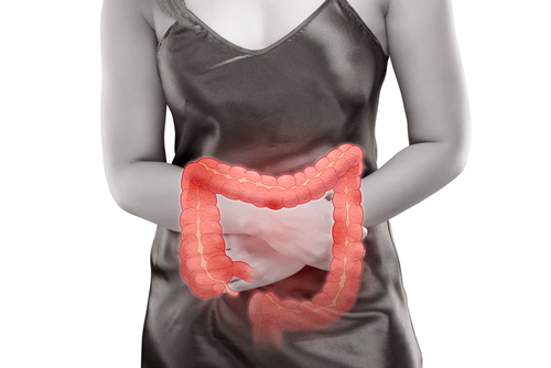 What Is the Link Between Endometriosis and IBS Symptoms?