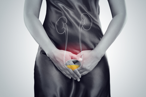 Women with Endometriosis More Likely to Develop Chronic Bladder Pain Syndrome, Study Affirms
